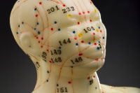 Acupuncture and Acupressure