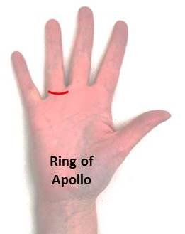 Ring of Apollo